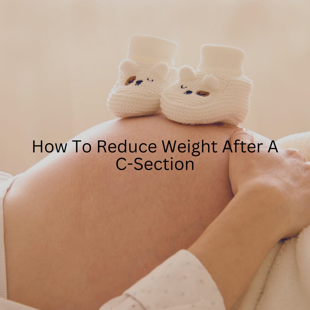 How To Lose Weight After A C-Section