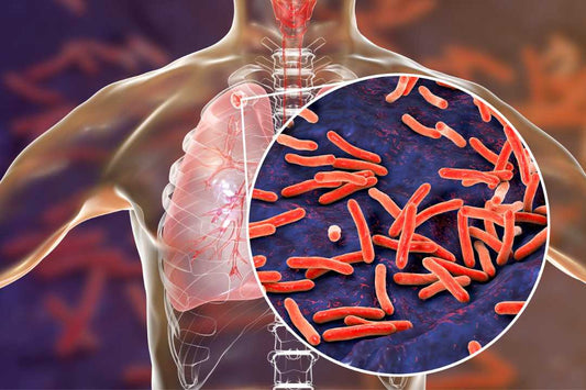 tuberculosis me kya khana chahiye, tb patient diet chart in hindi